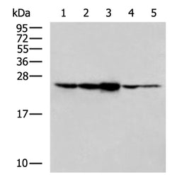 RAB11A rabbit polyclonal antibody