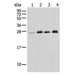 MOB4 rabbit polyclonal antibody
