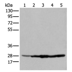ECI1 rabbit polyclonal antibody