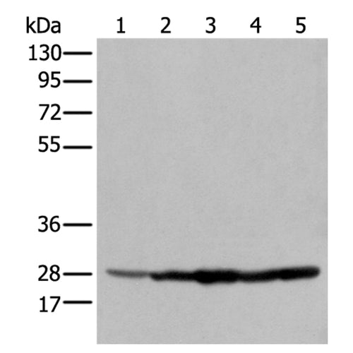 ECI1 rabbit polyclonal antibody