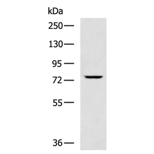 GCLC rabbit polyclonal antibody
