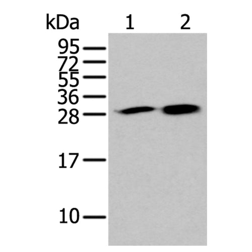 HDHD2 rabbit polyclonal antibody