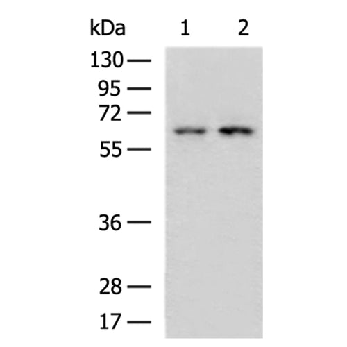 ZKSCAN3 rabbit polyclonal antibody