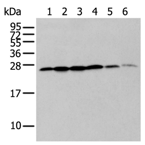 ZMAT2 rabbit polyclonal antibody