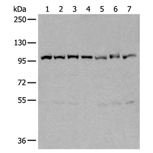 VCP rabbit polyclonal antibody
