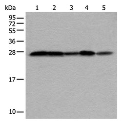 VTI1A rabbit polyclonal antibody