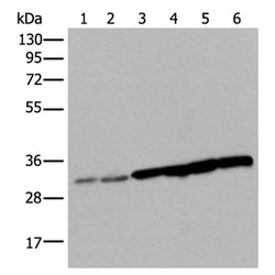 SNRPA rabbit polyclonal antibody