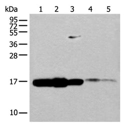UBE2V1 rabbit polyclonal antibody