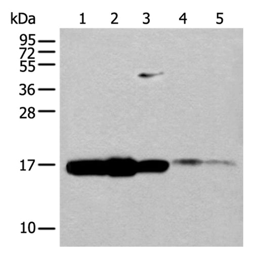 UBE2V1 rabbit polyclonal antibody
