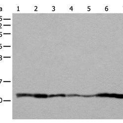 UQCRQ rabbit polyclonal antibody