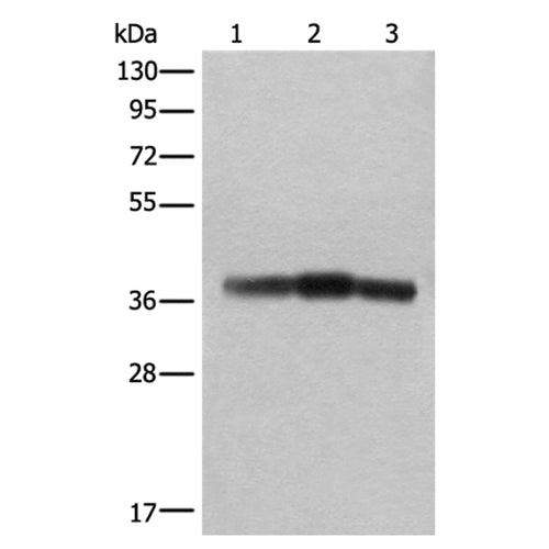 ATAD1 rabbit polyclonal antibody