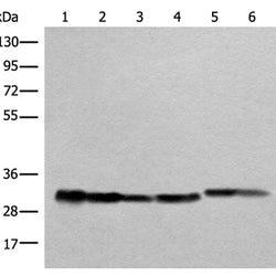ATP5F1C rabbit polyclonal antibody