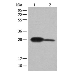 BDH2 rabbit polyclonal antibody