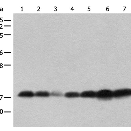 BUD31 rabbit polyclonal antibody