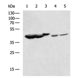 CKM rabbit polyclonal antibody
