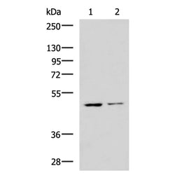 HAVCR1 rabbit polyclonal antibody