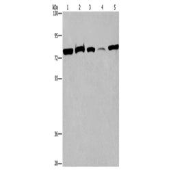 ACVR2A rabbit polyclonal antibody