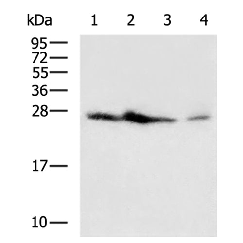 BCL2 rabbit polyclonal antibody