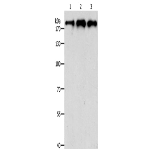 SMARCA4 rabbit polyclonal antibody