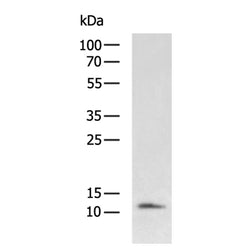CCL17 rabbit polyclonal antibody