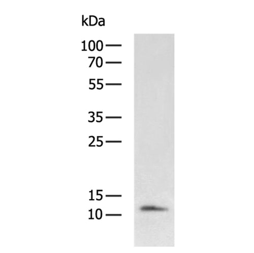 CCL17 rabbit polyclonal antibody