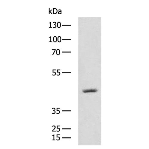CCR2 rabbit polyclonal antibody