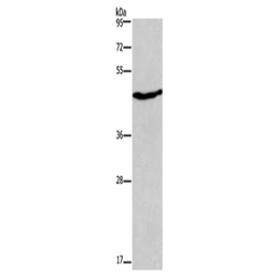 CCR8 rabbit polyclonal antibody