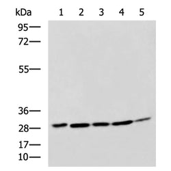 CEBPD rabbit polyclonal antibody
