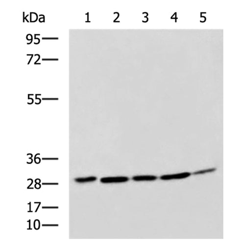 CEBPD rabbit polyclonal antibody