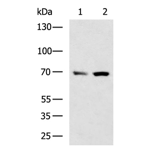 CPT2 rabbit polyclonal antibody