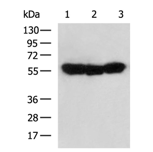 DPYSL3 rabbit polyclonal antibody