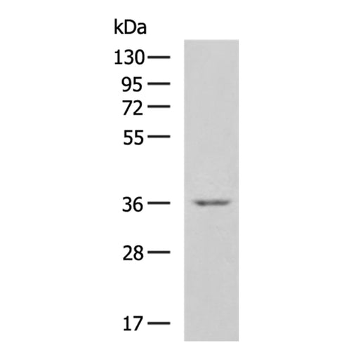 CCN2 rabbit polyclonal antibody