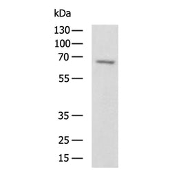DUSP8 rabbit polyclonal antibody