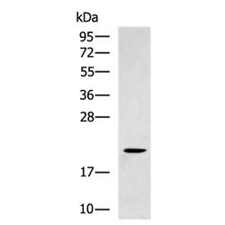 SUMO2/SUMO3/SUMO4 rabbit polyclonal antibody