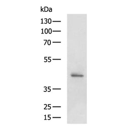 GRPR rabbit polyclonal antibody
