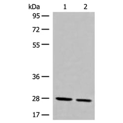GNRHR rabbit polyclonal antibody
