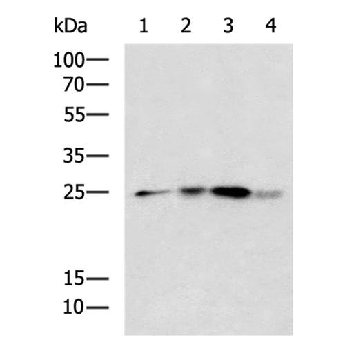 HMGB1 rabbit polyclonal antibody