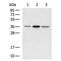 IGFBP7 rabbit polyclonal antibody