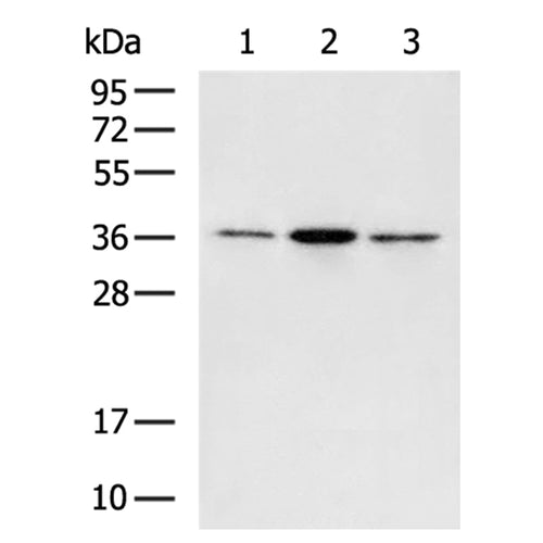 IGFBP7 rabbit polyclonal antibody