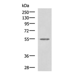 SLC16A1 rabbit polyclonal antibody