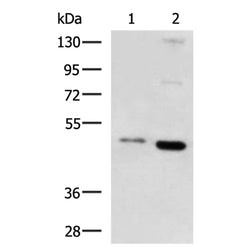 PAX5 rabbit polyclonal antibody
