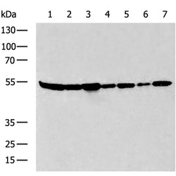 SLC1A5 rabbit polyclonal antibody