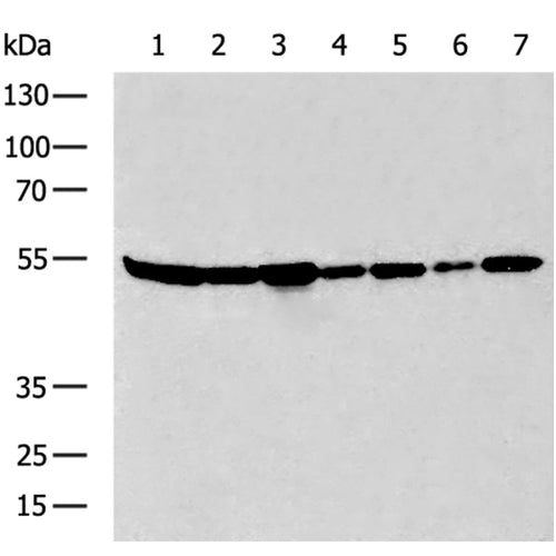 SLC1A5 rabbit polyclonal antibody