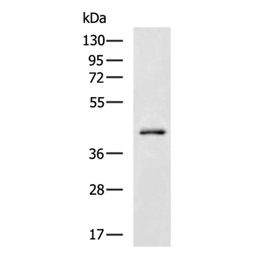 SMAD7 rabbit polyclonal antibody