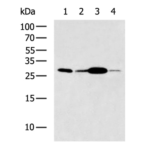 GJB4 rabbit polyclonal antibody