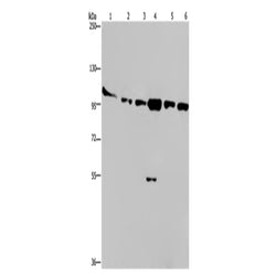 PRKD3 rabbit polyclonal antibody