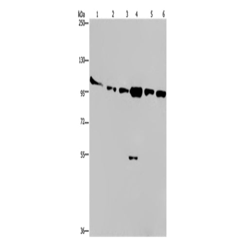 PRKD3 rabbit polyclonal antibody