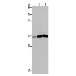 MAGEA3 rabbit polyclonal antibody