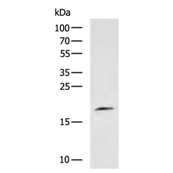 TNFRSF17 rabbit polyclonal antibody