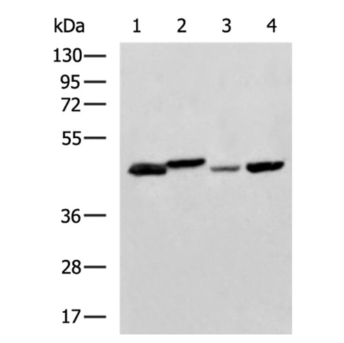 NDRG2 rabbit polyclonal antibody